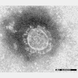 手ごわい（新型コロナウィルスの顕微鏡写真＝国立感染症研究所提供）