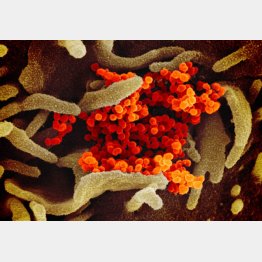 新型コロナウイルス SARS-CoV-2の顕微鏡イメージ（Ｃ）IMAGEPOINTFR=LPN／ニューズコム／共同通信イメージズ