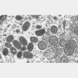 サル痘ウイルスの顕微鏡写真（CDC提供・共同）