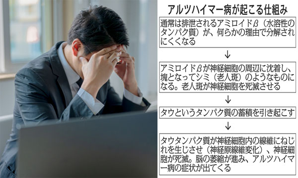 若年性アルツハイマー病の専門外来はほとんどない（Ｃ）日刊ゲンダイ