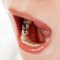 後悔しない歯科治療（1）「銀歯」は弊害が多く海外は禁止している