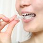 「歯ぎしり」は歯周病を悪化させ全身の健康を害する危険あり